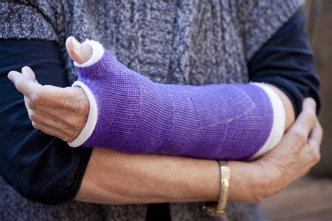 Signs That You Might Have a Fracture