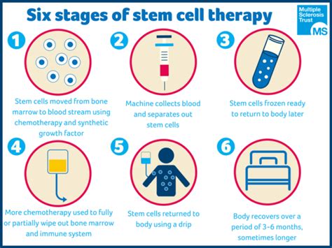 Read Latest News - Stem Cell Transplant Effective for Select MS Patients.