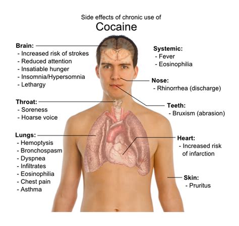 Long Term Effects of Cocaine - Effects on Mind and Body | Sober Nation