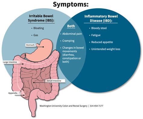 Ibs Stool