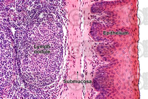 Man. Palatine tonsil. Transverse section. 250X - Man - Mammals ...