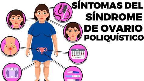 9 síntomas de ovarios poliquísticos que toda mujer debe conocer - YouTube