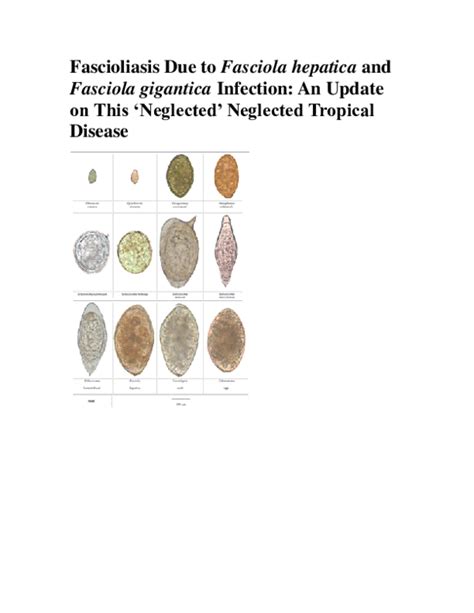 (DOC) Fascioliasis Due to Fasciola hepatica and Fasciola gigantica ...