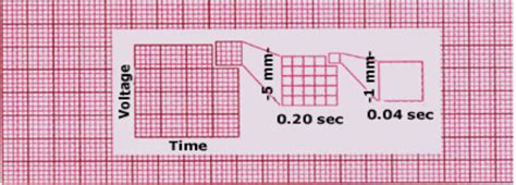 ecg-graph-paper - Cardiac Sciences Manitoba