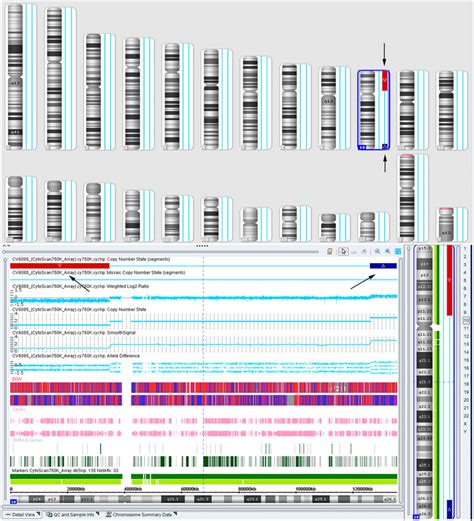 The SNP array detection results of in the fetus. The arrows indicated ...