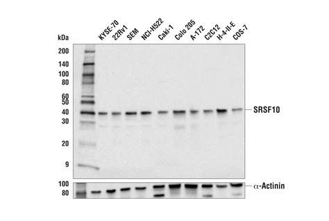 SRSF10 Antibody - BIOKÉ