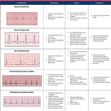 Basic EKG Interpretation 3 Pages Long Printable Pdf - Etsy | Ekg ...