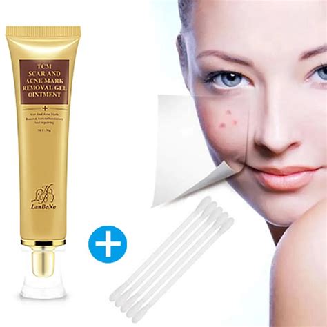 Brand New Acne Scar Removal Cream Skin Repair Face Cream Acne Spot ...