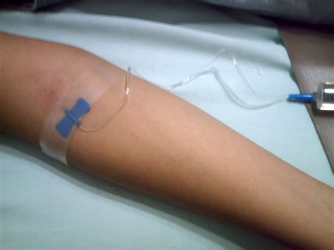 Injection (medicine) - wikidoc