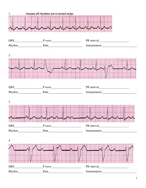 Ekg Practice Strips Printable With Answers