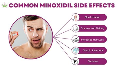 Minoxidil Side Effects for Men & Women: A Comprehensive Guide | Dr ...