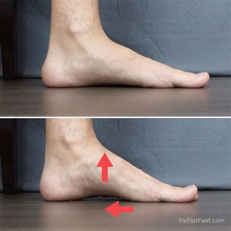 Exercises for Flat Feet - Fix Flat Feet | Flat feet, Foot exercises ...