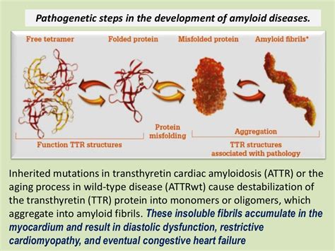 Cardiac Amyloidosis