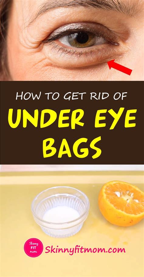 Check out these easy at-home remedies for dark circles! Keep reading to ...