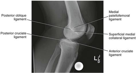 Adult Knee Radiographic Views - Trauma - Orthobullets