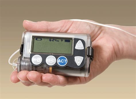 Insulin pumps: design basics and tradeoffs - EE Times