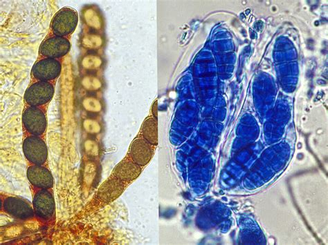 Ascomycota | Mycology | University of Adelaide