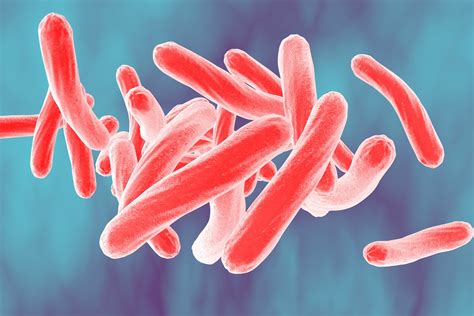 Why Have We Not Declared a Tuberculosis Pandemic? | SPH