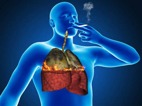 Smokers Or Past Smokers: Six Ways To Cleanse And Revitalize Your Lungs ...