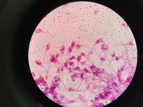 Penicillium Under the microscope #mycosis #microbiology