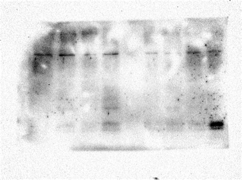 Black spots in Western Blot membrane?