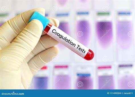 Blood for coagulation test stock photo. Image of experiment - 111499304