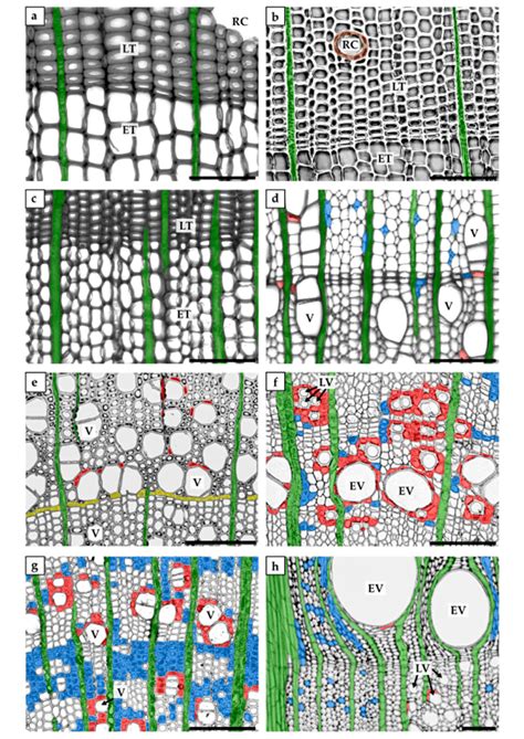 Types of xylem parenchyma cells of selected gymnosperm and angiosperm ...