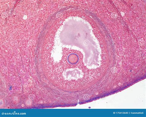 Follicle and Egg Cell in Human Ovary Under Microscope Stock Photo ...