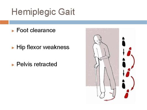 ABNORMAL GAIT Abnormal Gait Syndromes In general gait