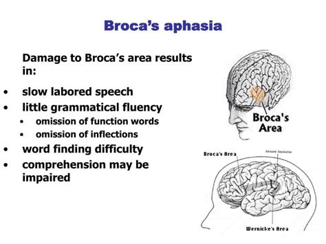 PPT - Aphasia PowerPoint Presentation - ID:5681188