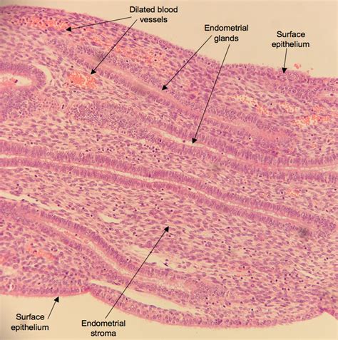 HistoQuarterly: ENDOMETRIUM | Histology Blog