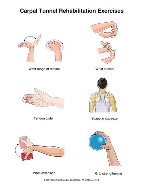 Printable Carpal Tunnel Exercises Pdf