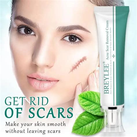 BREYLEE Acne Scar Removal Cream Face Cream Skin Repair Skin Care Scar ...