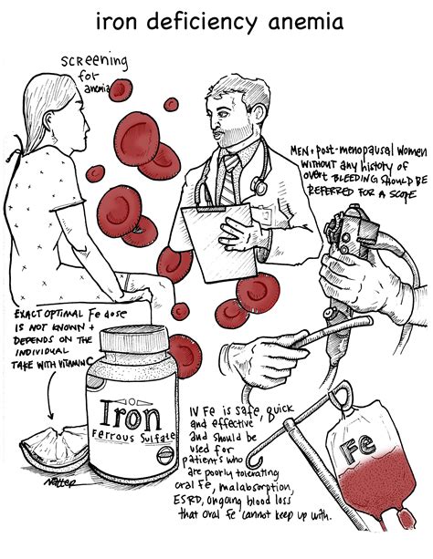 Core IM podcast: 5 Pearls on Iron Deficiency Anemia – Clinical Correlations