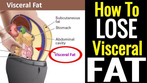 Best Exercise To Lose Visceral Fat – Online degrees