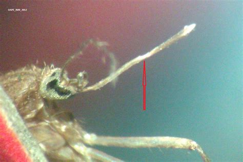 MEDICAL ENTOMOLOGY: Identification of Culex sp. (Adult)