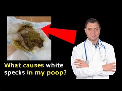 What causes white specks in my poop - YouTube