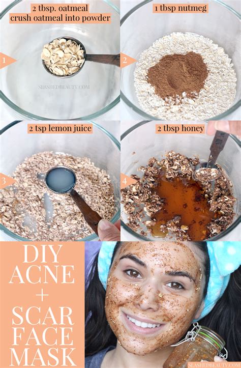 Best DIY Face Mask for Acne & Scars | Slashed Beauty