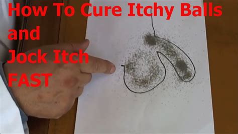 Itchy Balls Cure? Watch This OTC Miracle Jock Itch Treatment - YouTube