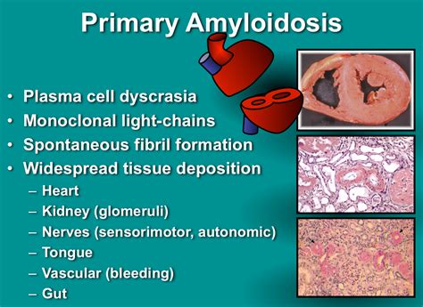 Amyloidosis : Causes ,Types, Symptoms, Treatments & Prognosis » How To ...