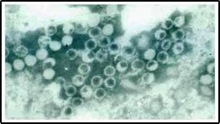 All about Viruses: Picornaviridae and Orthomyxoviridae