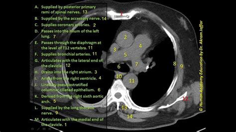 Anatomy question - superior mediastinum - axial CT 2 - YouTube