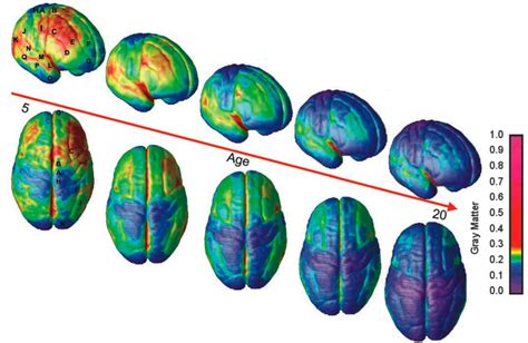 Teen Brain Development and Alcohol - BreakingTheCycles.com