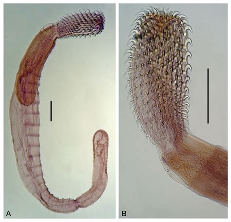 SciELO - Brasil - Acanthocephalan parasites of the flounder species ...