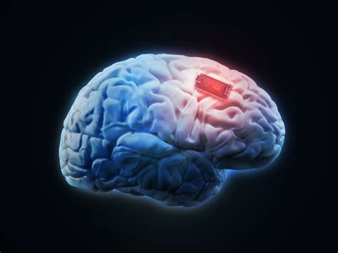 Brain Implant Could Help People With Memory Loss