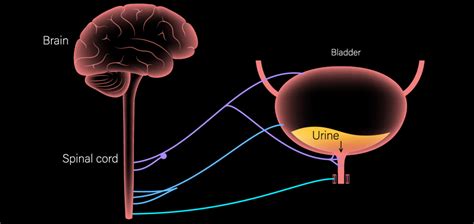 Neurogenic bladder: understanding loss of control | Happiest Health