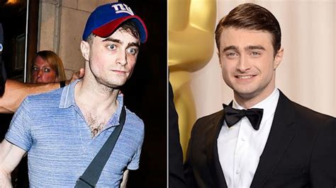 Daniel Radcliffe's 'Pale, Gaunt' Look Explained - ABC News