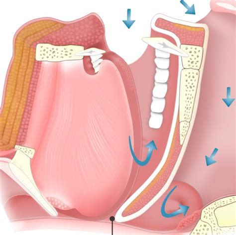 CPAP vs NIV for Ambulatory Patients With Obesity Hypoventilation ...