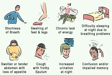 Heart Failure Symptoms Chart