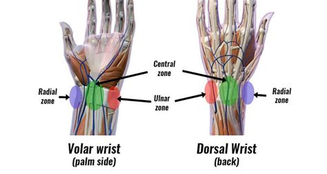 Wrist Pain By Location - Sportsinjuryclinic.net